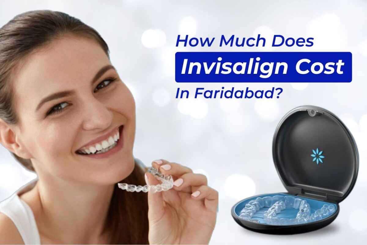 How-Much-Does-Invisalign-Cost-in-Faridabad-1-1200x800.jpg