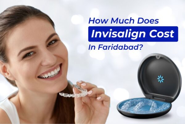 Invisible Braces Price in Faridabad
