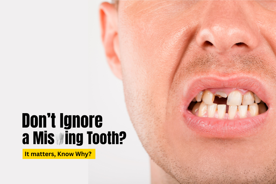 Don’t Ignore a Missing Tooth? It matters, Know Why?
