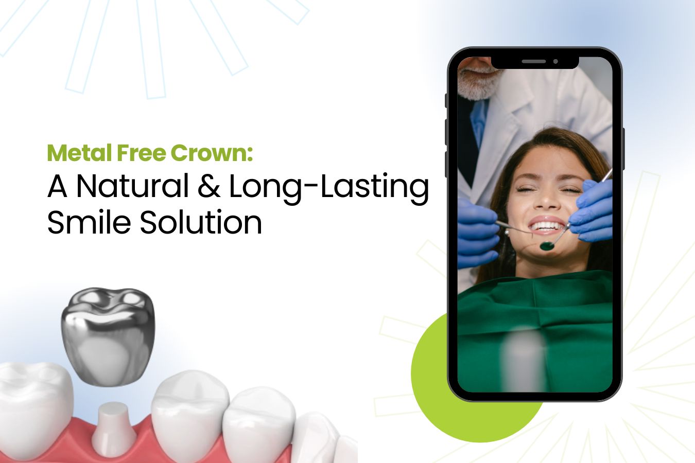 METAL FREE CROWN IN FARIDABAD